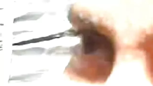 দুর্দশা, বাংলা সেকছ বিডিও পূর্বদেশীয়, জাপানি